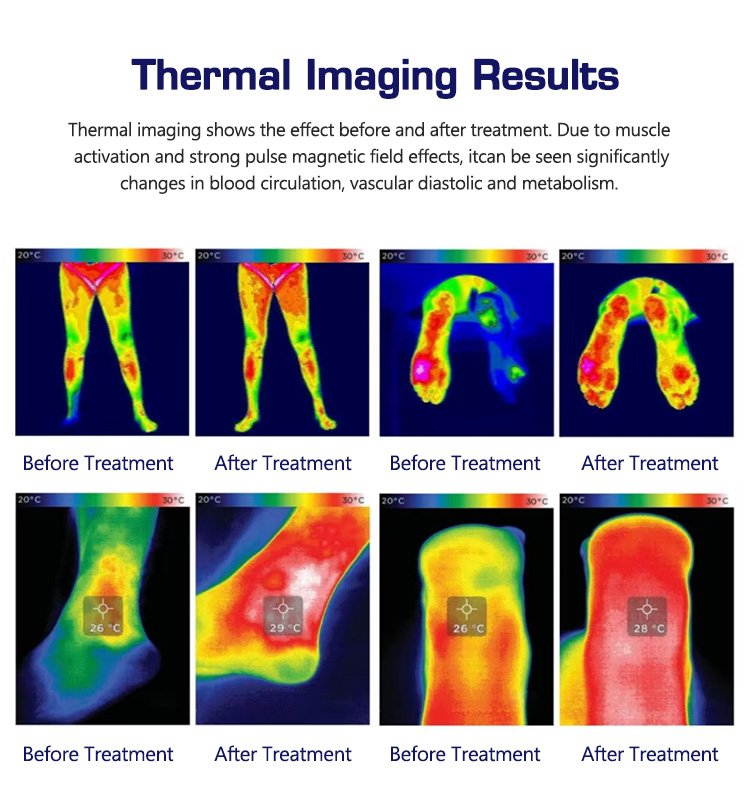MS-139 详情 12.jpg