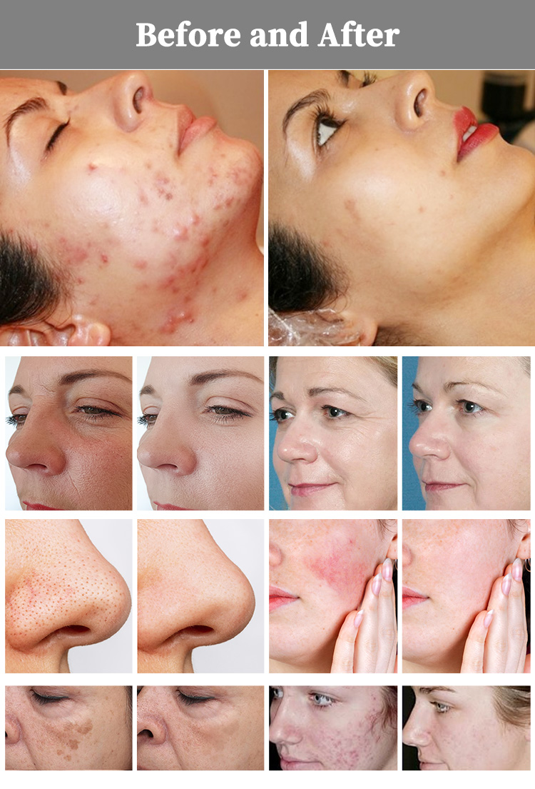 PL-139 详情 19.jpg